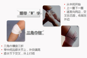 紅十字應(yīng)急救護(hù)技能系列講座——包扎——關(guān)于包扎方法
