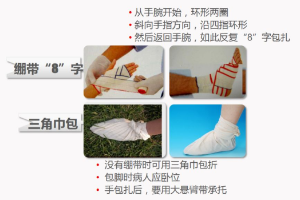 <em>紅十字</em><em>應急</em><em>救護</em><em>技能</em><em>系列講座</em>——<em>包扎</em>——手腳<em>包扎</em>方法