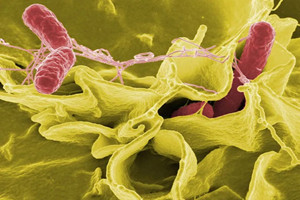 腸桿菌科：醫學<em>微生物</em>細菌學中的代表章節