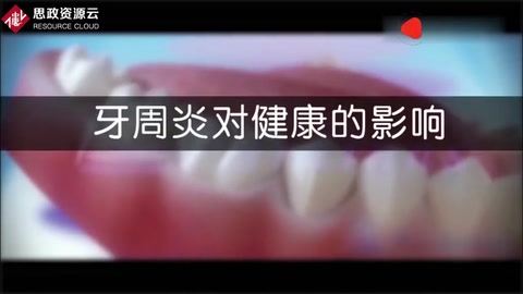 牙周炎病變過程及刮治，3D動(dòng)畫演示