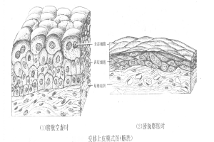 變易上皮<em>模式</em><em>圖</em>（膀胱）