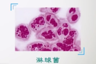 什么是淋?。?>
                    </div>
                    <div   id=