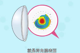 <em>什么</em>是<em>角膜</em>地形圖