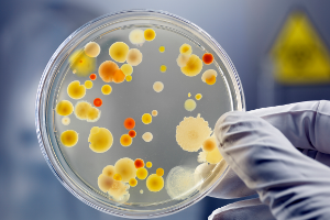 農產品加工與質量檢測專業：《微生物分析檢測—檢食品菌落，保人民安全—食品中菌落總數檢測》課程思政案例